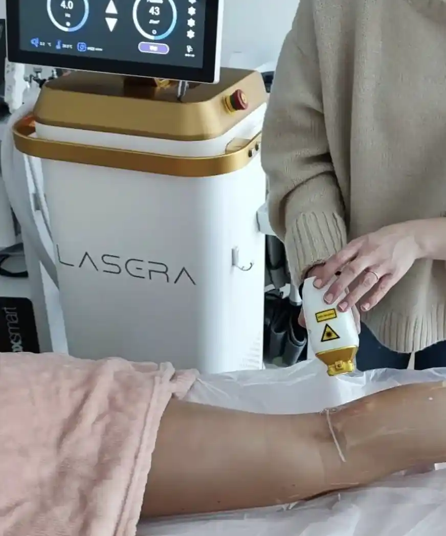 spa-cocooning dépilation diode laser sur la jambe